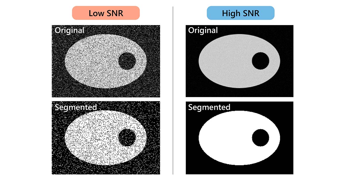 How to Improve the Signaltonoise Ratio of Xray CT Images